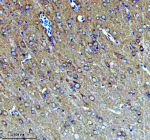 IHC analysis of KCNA6 using anti-KCNA6 antibody. KCNA6 was detected in a paraffin-embedded section of rat brain tissue. Heat mediated antigen retrieval was performed in EDTA buffer (pH 8.0, epitope retrieval solution). The tissue section was blocked with 10% goat serum. The tissue section was then incubated with 2 ug/ml rabbit anti-KCNA6 antibody overnight at 4oC. Peroxidase Conjugated Goat Anti-rabbit IgG was used as secondary antibody and incubated for 30 minutes at 37oC. The tissue section was developed using an HRP secondary and DAB substrate.