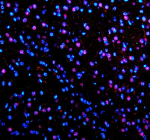 Immunofluorescent staining of PABPN1 using anti-PABPN1 antibody (red). PABPN1 was detected in a paraffin-embedded section of mouse brain tissue. Heat mediated antigen retrieval was performed in EDTA buffer (pH 8.0, epitope retrieval solution). The tissue section was blocked with 10% goat serum. The tissue section was then incubated with 5 ug/ml rabbit anti-PABPN1 antibody overnight at 4oC. Cy3 Conjugated Goat Anti-Rabbit IgG was used as secondary antibody at 1:500 dilution and incubated for 30 minutes at 37oC. The section was counterstained with DAPI (blue). Visualize using a fluorescence microscope and filter sets appropriate for the label used.