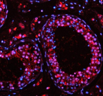 Immunofluorescent staining of PABPN1 using anti-PABPN1 antibody (red). PABPN1 was detected in a paraffin-embedded section of human testis tissue. Heat mediated antigen retrieval was performed in EDTA buffer (pH 8.0, epitope retrieval solution). The tissue section was blocked with 10% goat serum. The tissue section was then incubated with 5 ug/ml rabbit anti-PABPN1 antibody overnight at 4oC. Cy3 Conjugated Goat Anti-Rabbit IgG was used as secondary antibody at 1:500 dilution and incubated for 30 minutes at 37oC. The section was counterstained with DAPI (blue). Visualize using a fluorescence microscope and filter sets appropriate for the label used.