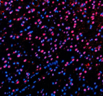 Immunofluorescent staining of PABPN1 using anti-PABPN1 antibody (red). PABPN1 was detected in a paraffin-embedded section of rat brain tissue. Heat mediated antigen retrieval was performed in EDTA buffer (pH 8.0, epitope retrieval solution). The tissue section was blocked with 10% goat serum. The tissue section was then incubated with 5 ug/ml rabbit anti-PABPN1 antibody overnight at 4oC. Cy3 Conjugated Goat Anti-Rabbit IgG was used as secondary antibody at 1:500 dilution and incubated for 30 minutes at 37oC. The section was counterstained with DAPI. Visualize using a fluorescence microscope and filter sets appropriate for the label used.