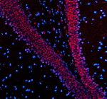 Immunofluorescent staining of PABPN1 using anti-PABPN1 antibody (red). PABPN1 was detected in a paraffin-embedded section of rat brain tissue. Heat mediated antigen retrieval was performed in EDTA buffer (pH 8.0, epitope retrieval solution). The tissue section was blocked with 10% goat serum. The tissue section was then incubated with 5 ug/ml rabbit anti-PABPN1 antibody overnight at 4oC. Cy3 Conjugated Goat Anti-Rabbit IgG was used as secondary antibody at 1:500 dilution and incubated for 30 minutes at 37oC. The section was counterstained with DAPI (blue). Visualize using a fluorescence microscope and filter sets appropriate for the label used.