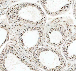 IHC analysis of PABPN1 using anti-PABPN1 antibody. PABPN1 was detected in a paraffin-embedded section of human testis tissue. Heat mediated antigen retrieval was performed in EDTA buffer (pH 8.0, epitope retrieval solution). The tissue section was blocked with 10% goat serum. The tissue section was then incubated with 2 ug/ml rabbit anti-PABPN1 antibody overnight at 4oC. Peroxidase Conjugated Goat Anti-rabbit IgG was used as secondary antibody and incubated for 30 minutes at 37oC. The tissue section was developed using an HRP secondary and DAB substrate.