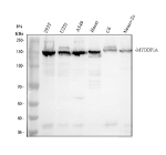 Western blot analysis of MYBBP1A using anti-MYBBP1A antibody. Electrophoresis was performed on a 8% SDS-PAGE gel at 80V (Stacking gel) / 120V (Resolving gel) for 2 hours. Lane 1: human 293T whole cell lysates, Lane 2: human U251 whole cell lysates, Lane 3: human whole cell lysates, Lane 4: human Hacat whole cell lysates, Lane 5: rat C6 whole cell lysates, Lane 6: mouse Neuro-2a whole cell lysates. After electrophoresis, proteins were transferred to a nitrocellulose membrane at 150 mA for 50-90 minutes. Blocked the membrane with 5% non-fat milk/TBS for 1.5 hour at RT. The membrane was incubated with rabbit anti-MYBBP1A antibody at 0.5 ug/ml overnight at 4oC, then washed with TBS-0.1%Tween 3 times with 5 minutes each and probed with a goat anti-rabbit IgG-HRP secondary antibody at a dilution of 1:5000 for 1.5 hour at RT. The signal was developed using an ECL Plus Western Blotting Substrate. A predominant doublet is observed at ~149-155 kDa, consistent with differential post-translationally modified forms of the nucleolar protein.