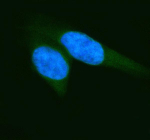 IF analysis of ELP2 using anti-ELP2 antibody (green). ELP2 was detected in an immunocytochemical section of Hela cells. Enzyme antigen retrieval was performed using IHC enzyme antigen retrieval reagent for 15 mins. The cells were blocked with 10% goat serum. And then incubated with 5 ug/ml rabbit anti-ELP2 antibody overnight at 4oC. DyLight 488 Conjugated Goat Anti-Rabbit IgG was used as secondary antibody at 1:500 dilution and incubated for 30 minutes at 37oC. The section was counterstained with DAPI (blue). Visualize using a fluorescence microscope and filter sets appropriate for the label used.
