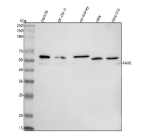 Western blot analysis of PAX8 using anti-PAX8 antibody. Lane 1: human SW579 whole cell lysates, Lane 2: human SK-OV-3 whole cell lysates, Lane 3: rat kidney tissue lysates, Lane 4: rat NRK whole cell lysates, Lane 5: mouse NIH/3T3 whole cell lysates. After electrophoresis, proteins were transferred to a nitrocellulose membrane at 150 mA for 50-90 minutes. Blocked the membrane with 5% non-fat milk/TBS for 1.5 hour at RT. The membrane was incubated with rabbit anti-PAX8 antibody at 0.5 ug/ml overnight at 4oC, then washed with TBS-0.1%Tween 3 times with 5 minutes each and probed with a goat anti-rabbit IgG-HRP secondary antibody at a dilution of 1:5000 for 1.5 hour at RT. The signal was developed using enhanced chemiluminescent. A specific band was detected for PAX8 at approximately 48 kDa. The expected band size for PAX8 is at 48 kDa.