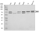 Western blot analysis of KEAP1 using anti-KEAP1 antibody. Lane 1: human Hela whole cell lysates, Lane 2: human Jurkat whole cell lysates, Lane 3: human 293T whole cell lysates, Lane 4: human HepG2 whole cell lysates, Lane 5: rat C6 whole cell lysates, Lane 6: mouse Neuro-2a whole cell lysates. After electrophoresis, proteins were transferred to a nitrocellulose membrane at 150 mA for 50-90 minutes. Blocked the membrane with 5% non-fat milk/TBS for 1.5 hour at RT. The membrane was incubated with rabbit anti-KEAP1 antibody at 0.5 ug/ml overnight at 4oC, then washed with TBS-0.1%Tween 3 times with 5 minutes each and probed with a goat anti-rabbit IgG-HRP secondary antibody at a dilution of 1:5000 for 1.5 hour at RT. The signal was developed using enhanced chemiluminescent. The expected band size for KEAP1 is at 70 kDa and it is often observed as a doublet with the higher band corresponding to the phosphorylated form of the protein.