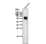 All lanes use the Phospho-Tau (Ser214) antibody at 1:1K dilution for 1 hour at room temperature.