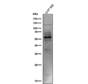 All lanes use the Phospho-Tau (Ser214) antibody at 1:1k dilution for 1 hour at room temperature.