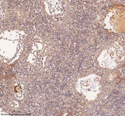 IHC staining of FFPE human spleen tissue with SAMD9L antibody, HRP-secondary and DAB substrate. HIER: boil tissue sections in pH8 EDTA for 20 min and allow to cool before testing.