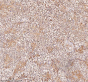 IHC staining of FFPE human testicular seminoma tissue with SAMD9L antibody, HRP-secondary and DAB substrate. HIER: boil tissue sections in pH8 EDTA for 20 min and allow to cool before testing.