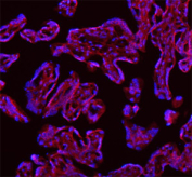 Immunofluorescent staining of FFPE human placental tissue with SAMD9L antibody (red) and DAPI nuclear stain (blue). HIER: steam section in pH8 EDTA buffer for 20 min.