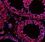IF analysis of TAF5 using anti-TAF5 antibody (red). TAF5 was detected in a paraffin-embedded section of human testis tissue. Heat mediated antigen retrieval was performed in EDTA buffer (pH 8.0, epitope retrieval solution). The tissue section was blocked with 10% goat serum. The tissue section was then incubated with 5 ug/ml rabbit anti-TAF5 antibody overnight at 4oC. Cy3 Conjugated Goat Anti-Rabbit IgG was used as secondary antibody at 1:500 dilution and incubated for 30 minutes at 37oC. The section was counterstained with DAPI (blue). Visualize using a fluorescence microscope and filter sets appropriate for the label used.