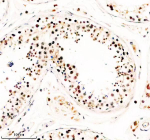IHC analysis of TAF5 using anti-TAF5 antibody. TAF5 was detected in a paraffin-embedded section of human testis tissue. Heat mediated antigen retrieval was performed in EDTA buffer (pH 8.0, epitope retrieval solution). The tissue section was blocked with 10% goat serum. The tissue section was then incubated with 2 ug/ml rabbit anti-TAF5 antibody overnight at 4oC. Peroxidase Conjugated Goat Anti-rabbit IgG was used as secondary antibody and incubated for 30 minutes at 37oC. The tissue section was developed using an HRP secondary and DAB substrate.