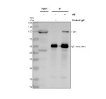Immunoprecipitating TAF5 in Hela whole cell lysate. Western blot analysis of TAF5 using anti-TAF5 antibody. Lane 1: Hela whole cell lysates (30ug), Lane 2: Rabbit control IgG instead of anti-TAF5 antibody in Hela whole cell lysate, Lane 3: anti-TAF5 antibody (2ug) + Hela whole cell lysate (500ug). After electrophoresis, proteins were transferred to a membrane. Then the membrane was incubated with rabbit anti-TAF5 antibody at a dilution of 0.5 ug/ml and probed with a goat anti-rabbit IgG-HRP secondary antibody. The signal is developed using ECL Plus Western Blotting Substrate. A specific band was detected for TAF5 at approximately 100 kDa. The expected band size for TAF5 is at 89 kDa.