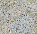 IHC analysis of PLD5 using anti-PLD5 antibody. PLD5 was detected in a paraffin-embedded section of rat cerebellum tissue. Heat mediated antigen retrieval was performed in EDTA buffer (pH 8.0, epitope retrieval solution). The tissue section was blocked with 10% goat serum. The tissue section was then incubated with 2 ug/ml rabbit anti-PLD5 antibody overnight at 4oC. Peroxidase Conjugated Goat Anti-rabbit IgG was used as secondary antibody and incubated for 30 minutes at 37oC. The tissue section was developed using an HRP secondary and DAB substrate.