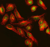 Immunofluorescent staining of TTC34 using anti-TTC34 antibody (green) and anti-Beta Tubulin antibody (red). TTC34 was detected in an immunocytochemical section of U2OS cells. Enzyme antigen retrieval was performed using IHC enzyme antigen retrieval reagent for 15 mins. The cells were blocked with 10% goat serum. And then incubated with 5 ug/ml rabbit anti-TTC34 antibody and mouse anti-Beta Tubulin antibody overnight at 4oC. DyLight 488 Conjugated Goat Anti-Rabbit IgG and DyLight 594 Conjugated Goat Anti-Mouse IgG were used as secondary antibody at 1:500 dilution and incubated for 30 minutes at 37oC. Visualize using a fluorescence microscope and filter sets appropriate for the label used.