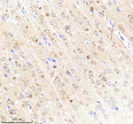 IHC analysis of SCNM1 using anti-SCNM1 antibody. SCNM1 was detected in a paraffin-embedded section of rat brain tissue. Heat mediated antigen retrieval was performed in EDTA buffer (pH 8.0, epitope retrieval solution). The tissue section was blocked with 10% goat serum. The tissue section was then incubated with 2 ug/ml rabbit anti-SCNM1 antibody overnight at 4oC. Peroxidase Conjugated Goat Anti-rabbit IgG was used as secondary antibody and incubated for 30 minutes at 37oC. The tissue section was developed using an HRP secondary and DAB substrate.
