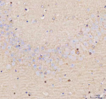IHC analysis of SCNM1 using anti-SCNM1 antibody. SCNM1 was detected in a paraffin-embedded section of mouse brain tissue. Heat mediated antigen retrieval was performed in EDTA buffer (pH 8.0, epitope retrieval solution). The tissue section was blocked with 10% goat serum. The tissue section was then incubated with 2 ug/ml rabbit anti-SCNM1 antibody overnight at 4oC. Peroxidase Conjugated Goat Anti-rabbit IgG was used as secondary antibody and incubated for 30 minutes at 37oC. The tissue section was developed using an HRP secondary and DAB substrate.