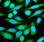 IF analysis of SEC63 using anti-SEC63 antibody (green). SEC63 was detected in an immunocytochemical section of SIHA cells. Enzyme antigen retrieval was performed using IHC enzyme antigen retrieval reagent for 15 mins. The cells were blocked with 10% goat serum. And then incubated with 5 ug/ml rabbit anti-SEC63 antibody overnight at 4oC. DyLight 488 Conjugated Goat Anti-Rabbit IgG was used as secondary antibody at 1:500 dilution and incubated for 30 minutes at 37oC. The section was counterstained with DAPI (blue). Visualize using a fluorescence microscope and filter sets appropriate for the label used.
