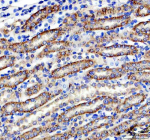IHC analysis of CLCN3 using anti-CLCN3 antibody. CLCN3 was detected in a paraffin-embedded section of rat kidney tissue. Heat mediated antigen retrieval was performed in EDTA buffer (pH 8.0, epitope retrieval solution). The tissue section was blocked with 10% goat serum. The tissue section was then incubated with 2 ug/ml rabbit anti-CLCN3 antibody overnight at 4oC. Peroxidase Conjugated Goat Anti-rabbit IgG was used as secondary antibody and incubated for 30 minutes at 37oC. The tissue section was developed using an HRP secondary and DAB substrate.