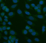 IF analysis of CLCN3 using anti-CLCN3 antibody (green). CLCN3 was detected in an immunocytochemical section of SiHa cells. Enzyme antigen retrieval was performed using IHC enzyme antigen retrieval reagent for 15 mins. The cells were blocked with 10% goat serum. And then incubated with 5 ug/ml rabbit anti-CLCN3 antibody overnight at 4oC. DyLight 488 Conjugated Goat Anti-Rabbit IgG was used as secondary antibody at 1:500 dilution and incubated for 30 minutes at 37oC. The section was counterstained with DAPI (blue). Visualize using a fluorescence microscope and filter sets appropriate for the label used.