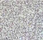 IHC analysis of IRF2BPL using anti-IRF2BPL antibody. IRF2BPL was detected in a paraffin-embedded section of follicles of human glioma tissue. Heat mediated antigen retrieval was performed in EDTA buffer (pH 8.0, epitope retrieval solution). The tissue section was blocked with 10% goat serum. The tissue section was then incubated with 2 ug/ml rabbit anti-IRF2BPL antibody overnight at 4oC. Peroxidase Conjugated Goat Anti-rabbit IgG was used as secondary antibody and incubated for 30 minutes at 37oC. The tissue section was developed using an HRP secondary and DAB substrate.