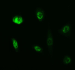 IF analysis of IRF2BPL using anti-IRF2BPL antibody (green). IRF2BPL was detected in an immunocytochemical section of TPC1 cells. Enzyme antigen retrieval was performed using IHC enzyme antigen retrieval reagent for 15 mins. The cells were blocked with 10% goat serum. And then incubated with 5 ug/ml rabbit anti-IRF2BPL antibody overnight at 4oC. DyLight 488 Conjugated Goat Anti-Rabbit IgG was used as secondary antibody at 1:500 dilution and incubated for 30 minutes at 37oC. Visualize using a fluorescence microscope and filter sets appropriate for the label used.