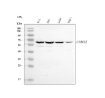Western blot analysis of CAMKK2 using anti-CAMKK2 antibody. Electrophoresis was performed on a 10% SDS-PAGE gel at 80V (Stacking gel) / 120V (Resolving gel) for 2 hours. Lane 1: human PC-3 whole cell lysates, Lane 2: human Hela whole cell lysates, Lane 3: human Jurkat whole cell lysates, Lane 4: human THP-1 whole cell lysates. After electrophoresis, proteins were transferred to a nitrocellulose membrane at 150 mA for 50-90 minutes. Blocked the membrane with 5% non-fat milk/TBS for 1.5 hour at RT. The membrane was incubated with rabbit anti-CAMKK2 antibody at 0.5 ug/ml overnight at 4oC, then washed with TBS-0.1%Tween 3 times with 5 minutes each and probed with a goat anti-rabbit IgG-HRP secondary antibody at a dilution of 1:5000 for 1.5 hour at RT. The signal was developed using an ECL Plus Western Blotting Substrate. A specific band was detected for CAMKK2 at approximately 65 kDa. The expected band size for CAMKK2 is at 65 kDa.
