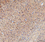 IHC analysis of CAMKK2 using anti-CAMKK2 antibody. CAMKK2 was detected in a paraffin-embedded section of rat brain tissue. Heat mediated antigen retrieval was performed in EDTA buffer (pH 8.0, epitope retrieval solution). The tissue section was blocked with 10% goat serum. The tissue section was then incubated with 2 ug/ml rabbit anti-CAMKK2 antibody overnight at 4oC. Peroxidase Conjugated Goat Anti-rabbit IgG was used as secondary antibody and incubated for 30 minutes at 37oC. The tissue section was developed using an HRP secondary and DAB substrate.