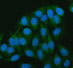 Immunofluorescent staining of CAMKK2 using anti-CAMKK2 antibody (green). CAMKK2 was detected in an immunocytochemical section of Hela cells. Enzyme antigen retrieval was performed using IHC enzyme antigen retrieval reagent for 15 mins. The cells were blocked with 10% goat serum. And then incubated with 5 ug/ml rabbit anti-CAMKK2 antibody overnight at 4oC. DyLight 488 Conjugated Goat Anti-Rabbit IgG was used as secondary antibody at 1:500 dilution and incubated for 30 minutes at 37oC. The section was counterstained with DAPI (blue). Visualize using a fluorescence microscope and filter sets appropriate for the label used.