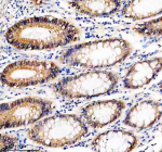 IHC analysis of UBE2A/UBE2B using anti-UBE2A/UBE2B antibody. UBE2A/UBE2B was detected in a paraffin-embedded section of human colon tissue. Heat mediated antigen retrieval was performed in EDTA buffer (pH 8.0, epitope retrieval solution). The tissue section was blocked with 10% goat serum. The tissue section was then incubated with 2 ug/ml rabbit anti-UBE2A/UBE2B antibody overnight at 4oC. Peroxidase Conjugated Goat Anti-rabbit IgG was used as secondary antibody and incubated for 30 minutes at 37oC. The tissue section was developed using an HRP secondary and DAB substrate.