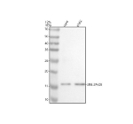 Western blot analysis of UBE2A/UBE2B using anti-UBE2A/UBE2B antibody. Electrophoresis was performed on a 12% SDS-PAGE gel at 80V (Stacking gel) / 120V (Resolving gel) for 2 hours. Lane 1: human Hela whole cell lysates, Lane 2: human K562 whole cell lysates. After electrophoresis, proteins were transferred to a nitrocellulose membrane at 150 mA for 50-90 minutes. Blocked the membrane with 5% non-fat milk/TBS for 1.5 hour at RT. The membrane was incubated with rabbit anti-UBE2A/UBE2B antibody at 0.5 ug/ml overnight at 4oC, then washed with TBS-0.1%Tween 3 times with 5 minutes each and probed with a goat anti-rabbit IgG-HRP secondary antibody at a dilution of 1:5000 for 1.5 hour at RT. The signal was developed using an ECL Plus Western Blotting Substrate. A specific band was detected for UBE2A/UBE2B at approximately 17 kDa. The expected band size for UBE2A/UBE2B is at 17 kDa.