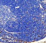 IHC analysis of FUBP1 using anti-FUBP1 antibody. FUBP1 was detected in a paraffin-embedded section of mouse spleen tissue. Heat mediated antigen retrieval was performed in EDTA buffer (pH 8.0, epitope retrieval solution). The tissue section was blocked with 10% goat serum. The tissue section was then incubated with 2 ug/ml rabbit anti-FUBP1 antibody overnight at 4oC. Peroxidase Conjugated Goat Anti-rabbit IgG was used as secondary antibody and incubated for 30 minutes at 37oC. The tissue section was developed using an HRP secondary and DAB substrate.