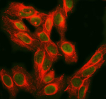 Immunofluorescent staining of FUBP1 using anti-FUBP1 antibody (green) and anti-Beta Tubulin antibody (red). FUBP1 was detected in an immunocytochemical section of U2OS cells. Enzyme antigen retrieval was performed using IHC enzyme antigen retrieval reagent for 15 mins. The cells were blocked with 10% goat serum. And then incubated with 5 ug/ml rabbit anti-FUBP1 antibody and mouse anti-Beta Tubulin antibody overnight at 4oC. DyLight 488 Conjugated Goat Anti-Rabbit IgG and Cy3 Conjugated Goat Anti-Mouse IgG were used as secondary antibody at 1:500 dilution and incubated for 30 minutes at 37oC. Visualize using a fluorescence microscope and filter sets appropriate for the label used.