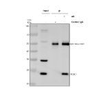 Immunoprecipitating TUSC1 in Hela whole cell lysate. Western blot analysis of TUSC1 using anti-TUSC1 antibody. Lane 1: Hela whole cell lysates (30ug), Lane 2: Rabbit control IgG instead of anti-TUSC1 antibody in Hela whole cell lysate, Lane 3: anti-TUSC1 antibody (2ug) + Hela whole cell lysate (500ug). After electrophoresis, proteins were transferred to a membrane. Then the membrane was incubated with rabbit anti-TUSC1 antibody at a dilution of 0.5 ug/ml and probed with a goat anti-rabbit IgG-HRP secondary antibody. The signal is developed using ECL Plus Western Blotting Substrate. A specific band was detected for TUSC1 at approximately 25 kDa. The expected band size for TUSC1 is at 23 kDa.
