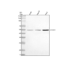 Western blot analysis of CYP4F2 using anti-CYP4F2 antibody. Lane 1: human whole cell lysates, Lane 2: human HepG2 whole cell lysates, Lane 3: human K562 whole cell lysates. After electrophoresis, proteins were transferred to a nitrocellulose membrane at 150 mA for 50-90 minutes. Blocked the membrane with 5% non-fat milk/TBS for 1.5 hour at RT. The membrane was incubated with rabbit anti-CYP4F2 antibody at 0.5 ug/ml overnight at 4oC, then washed with TBS-0.1%Tween 3 times with 5 minutes each and probed with a goat anti-rabbit IgG-HRP secondary antibody at a dilution of 1:5000 for 1.5 hour at RT. The signal was developed using enhanced chemiluminescent. A specific band was detected for CYP4F2 at approximately 50 kDa. The expected band size for CYP4F2 is at 60 kDa.