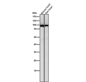 All lanes use the PKC antibody at 1:5K dilution for 1 hour at room temperature.
