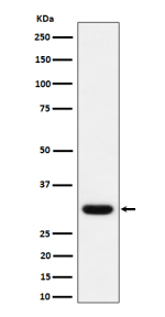 Western blot analysis of Adiponectin expression in human plasma lysate using ADIPOQ antibody.
