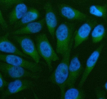 Immunofluorescent staining of TOM1 using anti-TOM1 antibody (green). TOM1 was detected in an immunocytochemical section of HELA cells. Enzyme antigen retrieval was performed using IHC enzyme antigen retrieval reagent for 15 mins. The cells were blocked with 10% goat serum. And then incubated with 5 ug/ml rabbit anti-TOM1 antibody overnight at 4oC. DyLight 488 Conjugated Goat Anti-Rabbit IgG was used as secondary antibody at 1:500 dilution and incubated for 30 minutes at 37oC. The section was counterstained with DAPI nuclear stain (blue). Visualize using a fluorescence microscope and filter sets appropriate for the label used.