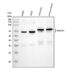 Western blot analysis of PHACTR1 using anti-PHACTR1 antibody. Lane 1: human whole cell lysates, Lane 2: human 293T whole cell lysates, Lane 3: rat brain tissue lysates, Lane 4: mouse brain tissue lysates. After electrophoresis, proteins were transferred to a nitrocellulose membrane at 150 mA for 50-90 minutes. Blocked the membrane with 5% non-fat milk/TBS for 1.5 hour at RT. The membrane was incubated with rabbit anti-PHACTR1 antibody at 0.5 ug/ml overnight at 4oC, then washed with TBS-0.1%Tween 3 times with 5 minutes each and probed with a goat anti-rabbit IgG-HRP secondary antibody at a dilution of 1:5000 for 1.5 hour at RT. The signal was developed using enhanced chemiluminescent. The expected band size for PHACTR1 is at ~66 kDa but it is commonly observed at 66-75 kDa due to phosphorylation. The mouse and rat protein are slightly larger than the human protein.