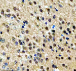 Immunohistochemical staining of NPAT using anti-NPAT antibody. NPAT was detected in a paraffin-embedded section of mouse brain tissue. Heat mediated antigen retrieval was performed in EDTA buffer (pH 8.0, epitope retrieval solution). The tissue section was blocked with 10% goat serum. The tissue section was then incubated with 2 ug/ml rabbit anti-NPAT antibody overnight at 4oC. Peroxidase Conjugated Goat Anti-rabbit IgG was used as secondary antibody and incubated for 30 minutes at 37oC. The tissue section was developed using an HRP secondary and DAB substrate.
