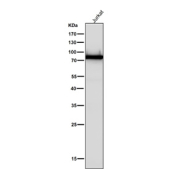 All lanes use the PRKCA/B/G antibody at 1:5K dilution for 1 hour at room temperature.