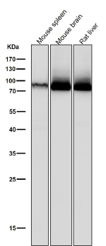 All lanes use the PRKCA/B/G antibody at 1:5K dilution for 1 hour at room temperature.