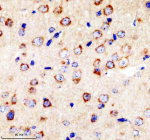 Immunohistochemical staining of SORL1 using anti-SORL1 antibody. SORL1 was detected in a paraffin-embedded section of mouse brain tissue. Heat mediated antigen retrieval was performed in EDTA buffer (pH 8.0, epitope retrieval solution). The tissue section was blocked with 10% goat serum. The tissue section was then incubated with 2 ug/ml rabbit anti-SORL1 antibody overnight at 4oC. Peroxidase Conjugated Goat Anti-rabbit IgG was used as secondary antibody and incubated for 30 minutes at 37oC. The tissue section was developed using an HRP secondary and DAB substrate.