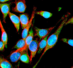 Immunofluorescent staining of IMMP2L using anti-IMMP2L antibody (green) and anti-Beta Tubulin antibody (red). IMMP2L was detected in an immunocytochemical section of Hela cells. Enzyme antigen retrieval was performed using IHC enzyme antigen retrieval reagent for 15 mins. The cells were blocked with 10% goat serum. And then incubated with 5 ug/ml rabbit anti-IMMP2L antibody and mouse anti-Beta Tubulin antibody overnight at 4oC. DyLight 488 Conjugated Goat Anti-Rabbit IgG and Cy3 Conjugated Goat Anti-Mouse IgG were used as secondary antibody at 1:500 dilution and incubated for 30 minutes at 37oC. The section was counterstained with DAPI nuclear stain (blue). Visualize using a fluorescence microscope and filter sets appropriate for the label used.