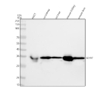 Western blot analysis of GLYAT using anti-GLYAT antibody. Lane 1: human hepatocellular carcinoma tumor tissue (HCCT) lysates, Lane 2: rat kidney tissue lysates, Lane 3: rat liver tissue lysates, Lane 4: mouse kidney tissue lysates, Lane 5: mouse liver tissue lysates. After electrophoresis, proteins were transferred to a nitrocellulose membrane at 150 mA for 50-90 minutes. Blocked the membrane with 5% non-fat milk/TBS for 1.5 hour at RT. The membrane was incubated with rabbit anti-GLYAT antibody at 0.5 ug/ml overnight at 4oC, then washed with TBS-0.1%Tween 3 times with 5 minutes each and probed with a goat anti-rabbit IgG-HRP secondary antibody at a dilution of 1:5000 for 1.5 hour at RT. The signal was developed using enhanced chemiluminescent. A specific band was detected for GLYAT at approximately 34 kDa. The expected band size for GLYAT is at 34 kDa.