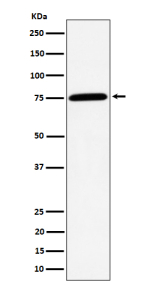 Western blot analysis of PPM1G expression in Jurkat cell lysate using PPM1G antibody.