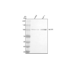 Western blot analysis of NLRP6 using anti-NLRP6 antibody. Electrophoresis was performed on a 8% SDS-PAGE gel at 80V (Stacking gel) / 120V (Resolving gel) for 2 hours. Lane 1: human Jurkat whole cell lysates, Lane 2: human THP-1 whole cell lysates. After electrophoresis, proteins were transferred to a nitrocellulose membrane at 150 mA for 50-90 minutes. Blocked the membrane with 5% non-fat milk/TBS for 1.5 hour at RT. The membrane was incubated with rabbit anti-NLRP6 antibody at 0.5 ug/ml overnight at 4oC, then washed with TBS-0.1%Tween 3 times with 5 minutes each and probed with a goat anti-rabbit IgG-HRP secondary antibody at a dilution of 1:5000 for 1.5 hour at RT. The signal was developed using an ECL Plus Western Blotting Substrate. The expected band size for NLRP6 is at 99 kDa.