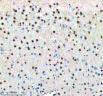 Immunohistochemical staining of NUP93 using anti-NUP93 antibody. NUP93 was detected in a paraffin-embedded section of rat brain tissue. Heat mediated antigen retrieval was performed in EDTA buffer (pH 8.0, epitope retrieval solution). The tissue section was blocked with 10% goat serum. The tissue section was then incubated with 2 ug/ml rabbit anti-NUP93 antibody overnight at 4oC. Peroxidase Conjugated Goat Anti-rabbit IgG was used as secondary antibody and incubated for 30 minutes at 37oC. The tissue section was developed using an HRP secondary and DAB substrate.