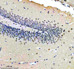 Immunohistochemical staining of NUP93 using anti-NUP93 antibody. NUP93 was detected in a paraffin-embedded section of mouse brain tissue. Heat mediated antigen retrieval was performed in EDTA buffer (pH 8.0, epitope retrieval solution). The tissue section was blocked with 10% goat serum. The tissue section was then incubated with 2 ug/ml rabbit anti-NUP93 antibody overnight at 4oC. Peroxidase Conjugated Goat Anti-rabbit IgG was used as secondary antibody and incubated for 30 minutes at 37oC. The tissue section was developed using an HRP secondary and DAB substrate.
